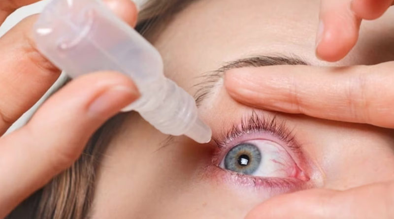 Conjunctivitis can be called the 'new COVID like epidemic', doctors says। Sangbad Pratidin