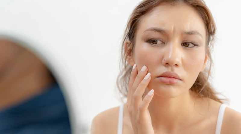 Skin Care: Do not use medicine without Doctor's advice | Sangbad Pratidin
