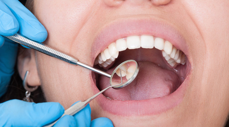 oral-hygiene