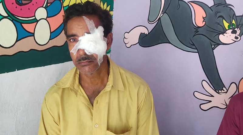 Man allegedly harrassed at CPM party office at Katwa regarding resloving couple related isssues