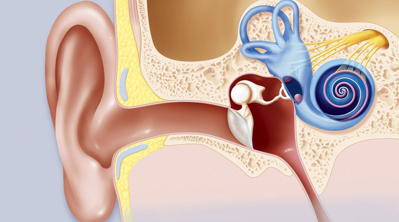 acoustic neuroma