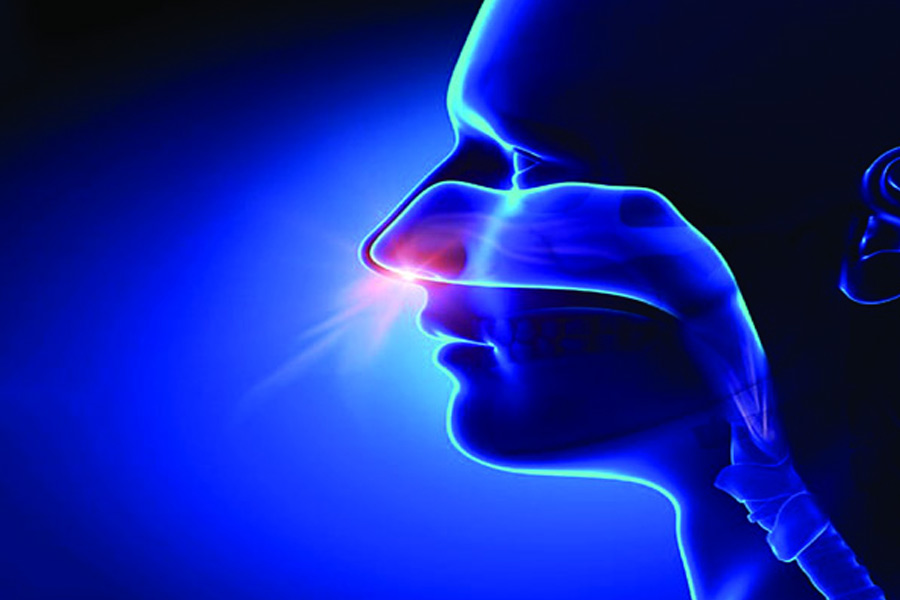 Nasal-polyps-1
