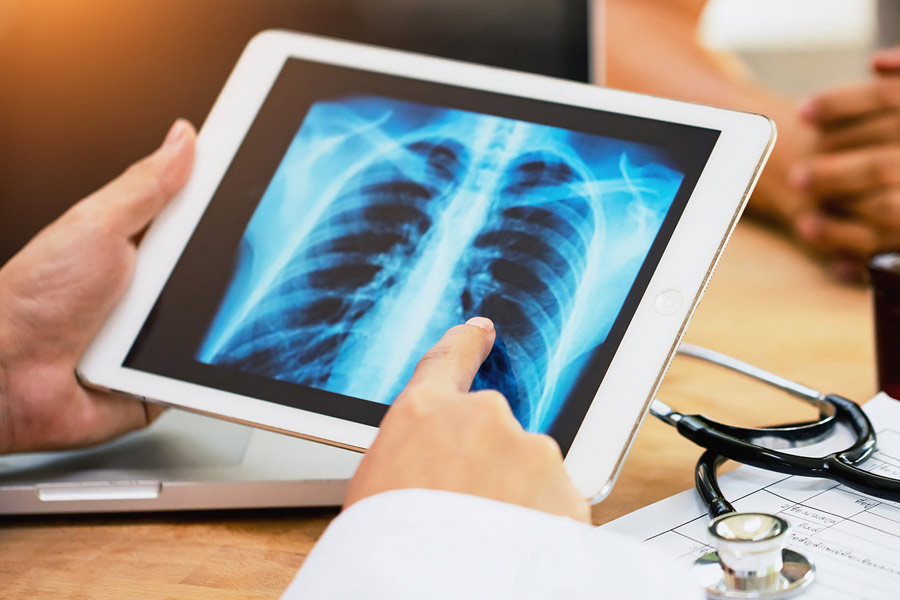 Health tips about Pulmonary Cysts, know causes and treatments | Sangbad Pratidin