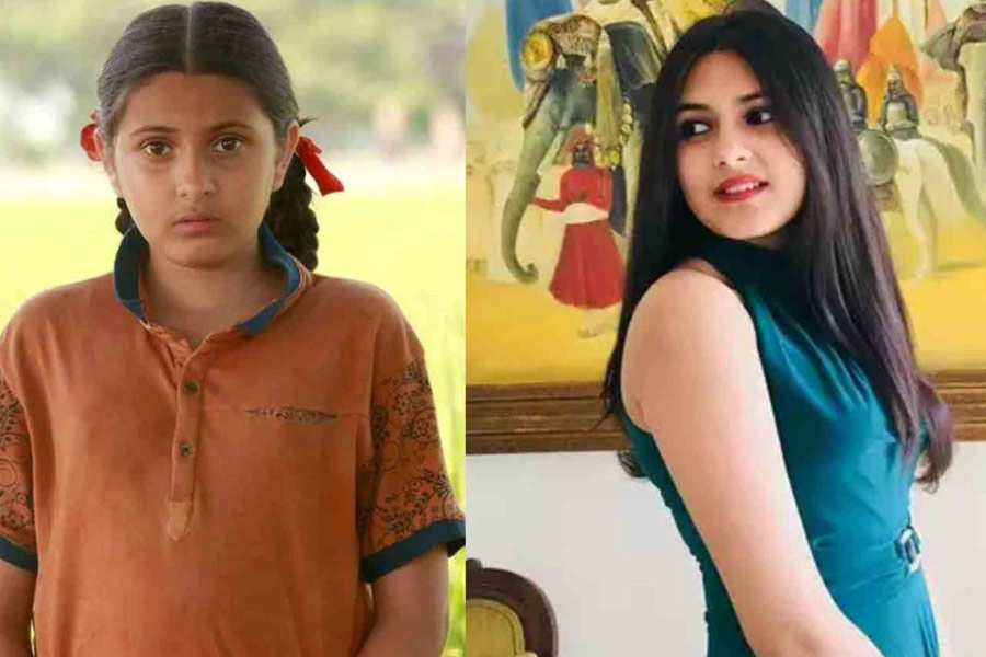 Dangal actor Suhani Bhatnagar dies due to Dermatomyositis: What is it? | Sangbad Pratidin
