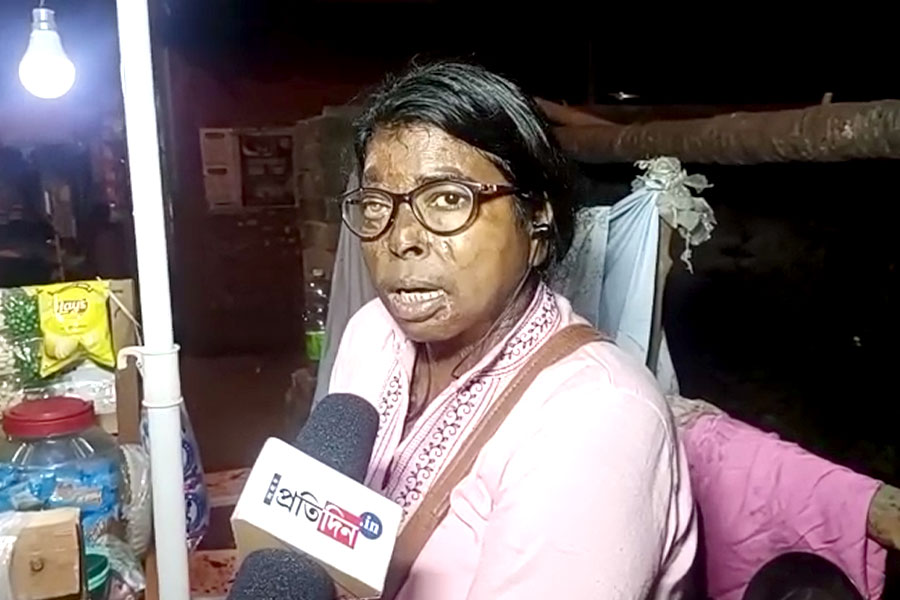 A woman is fighting acid attack without giving up