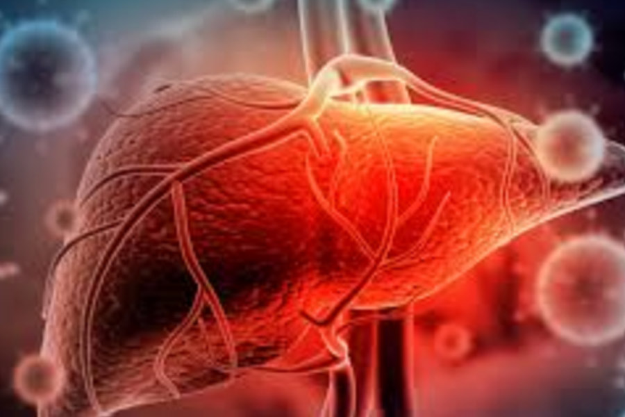 Hepatitis infections claiming 3,500 lives every day, WHO sounds alarm