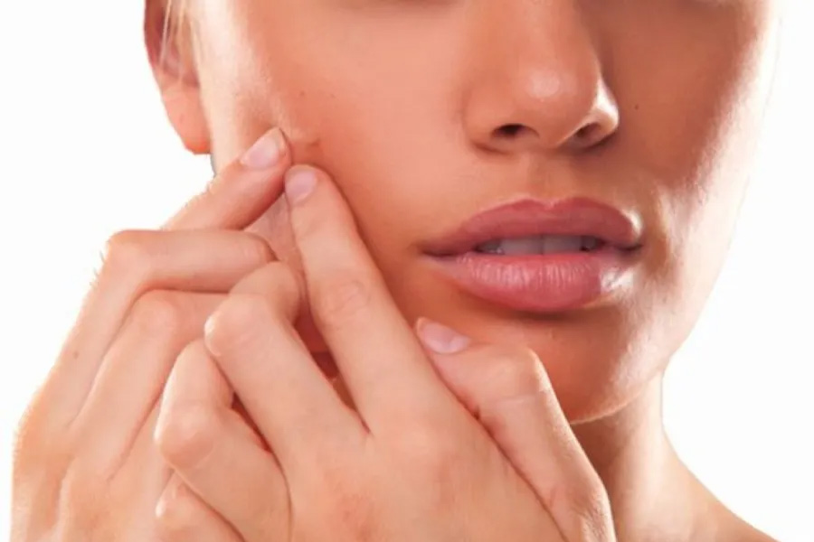 Easy home remedies to get rid of boils in Summer, Know this Health tips
