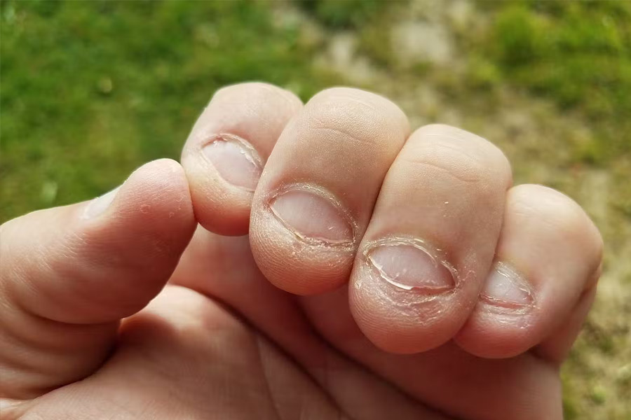 Nail-1