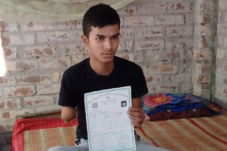 Right hand cut due to cancer, candidate passed madhyamik exam