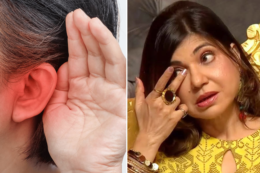 What is Sensorineural Hearing Loss? Expert gave important health tips