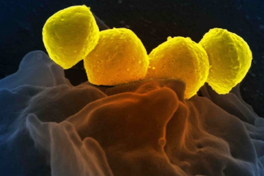 Rare flesh-eating bacteria spreads in Japan very fast