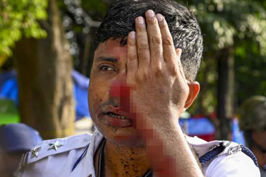 A traffic Sargent who was present in Nabanna Abhijan may lose eyesight