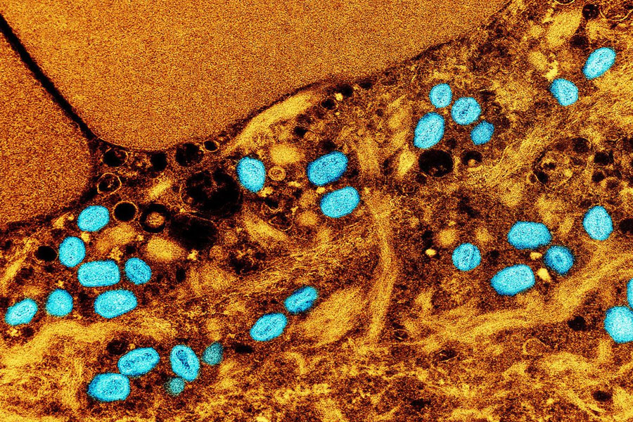 Indian Airports, Borders On Alert As Global Mpox Cases Rise