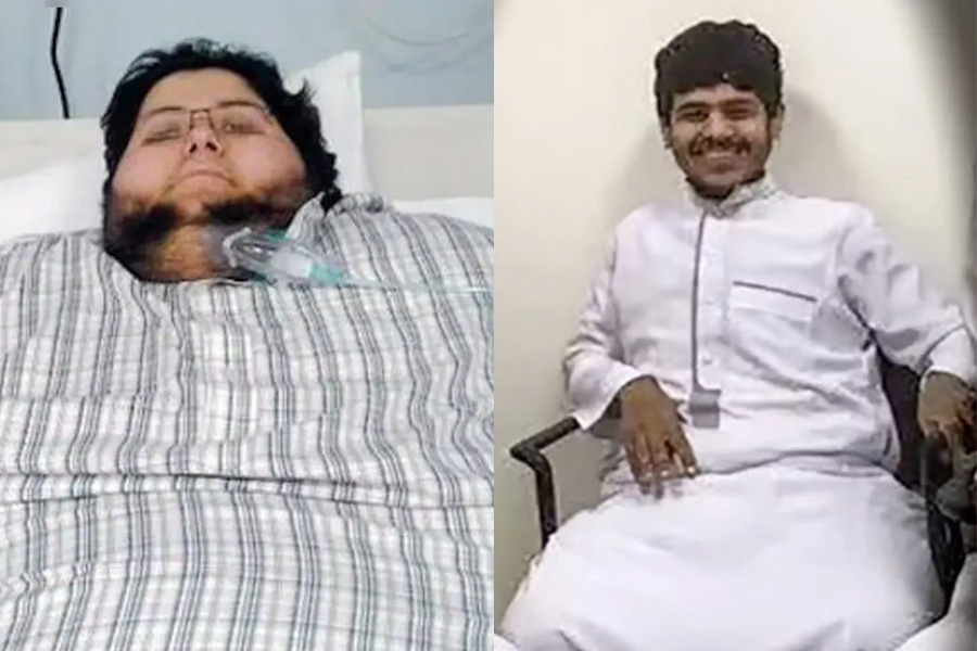 Saudi Man Loses Over 500 Kilos