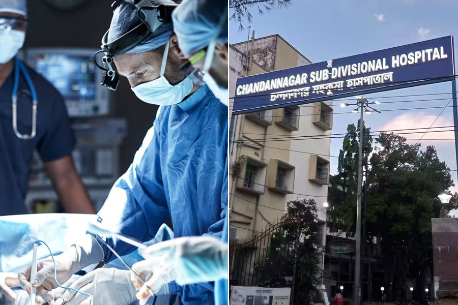 Rare surgery at Chandannagar Hospital