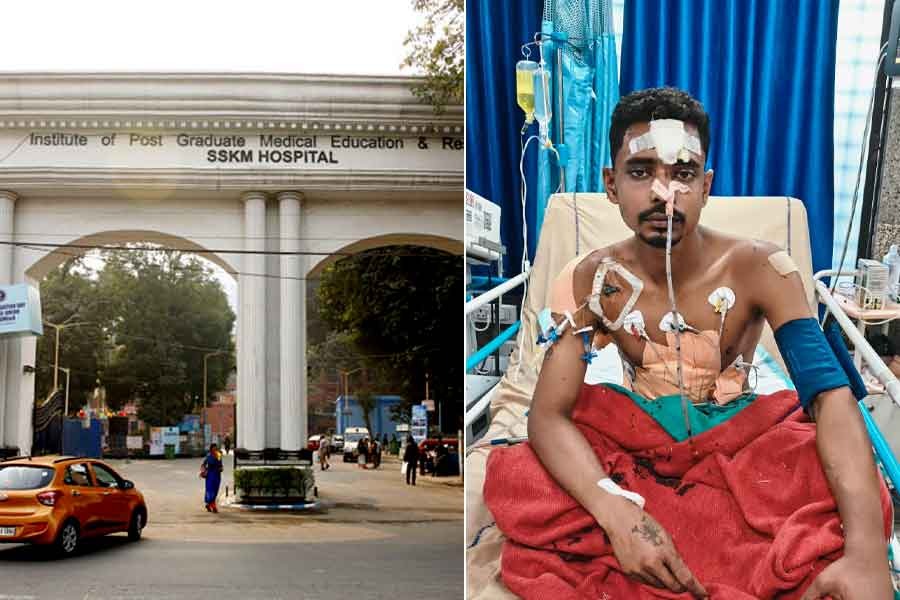 SSKM Hospital: Surgery Department of PG Hospital Sets a Record After Successfully Operating on a Patient Who Met with a Severe Accident