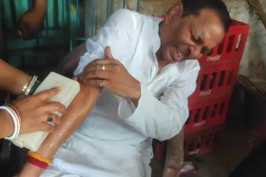 TMC MLA Akhil Giri injured during Contai Co Operative Election