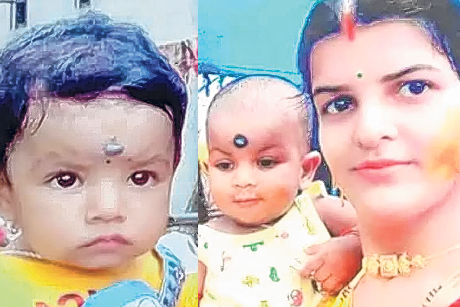 Offbeat News: Conjoined twins separated by rare operation 25 years ago