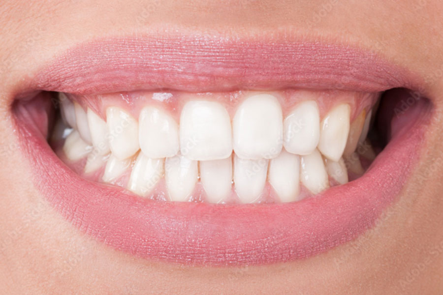 'Rebirth' of teeth, historic breakthrough in research