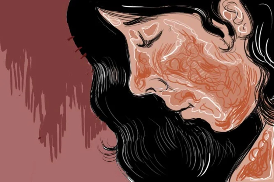 Man attacked his wife and daughters with acid in Uttar Pradesh