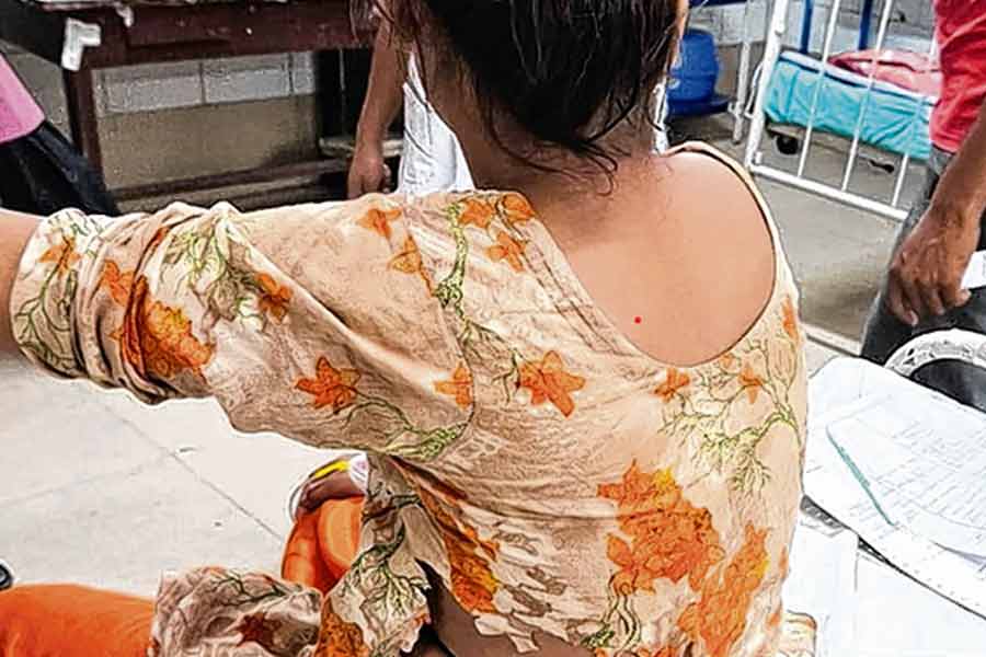Doctors at Murshidabad Hospital save teenager from risky surgery