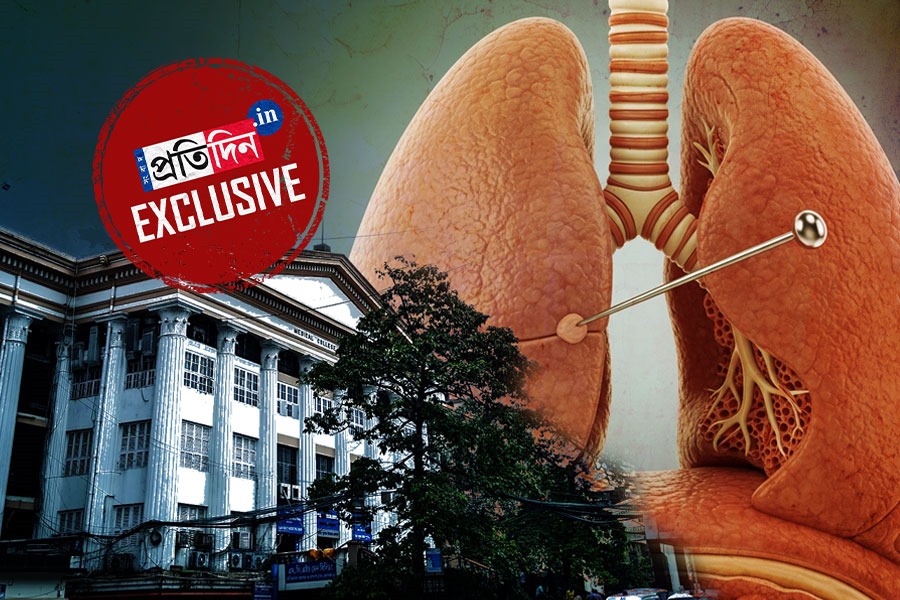 ফুসফুসে পিন, সরকারি হাসপাতালেই মৃত্যুর মুখ থেকে ফিরল স্বরূপনগরের কিশোর