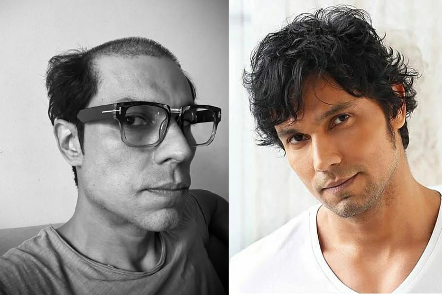 অর্ধেক টাক, অর্ধেক চুল! হঠাৎ একী সাজে রণদীপ হুডা! নতুন কোনও চমক?