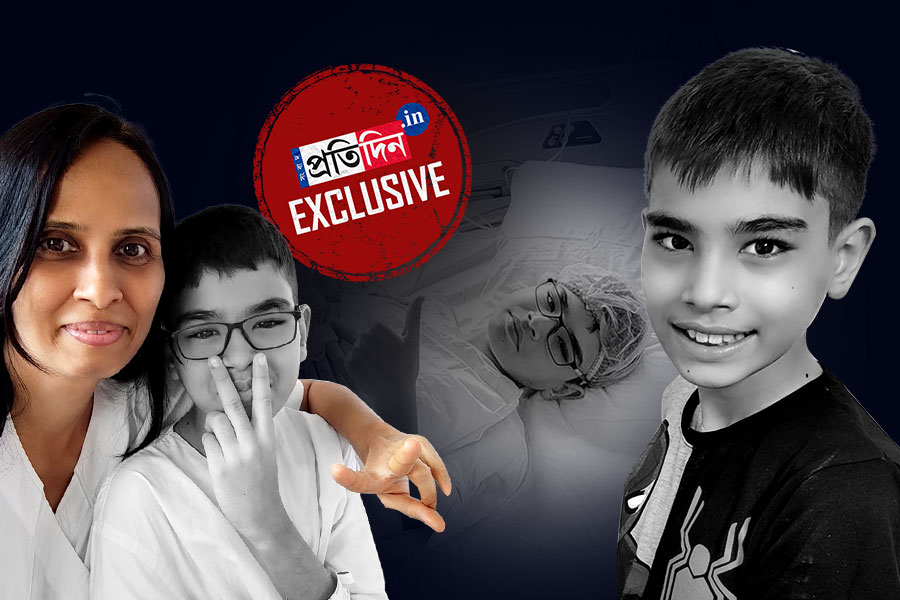 অঙ্গ হারিয়েও জীবনদান, ১২ বছরেই অমর যাদবপুরের উমাঙ্গ