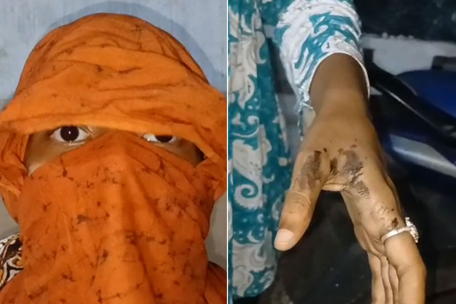 উত্তরপাড়ায় ফের তরুণীকে লক্ষ্য করে কেমিক্যাল হামলা