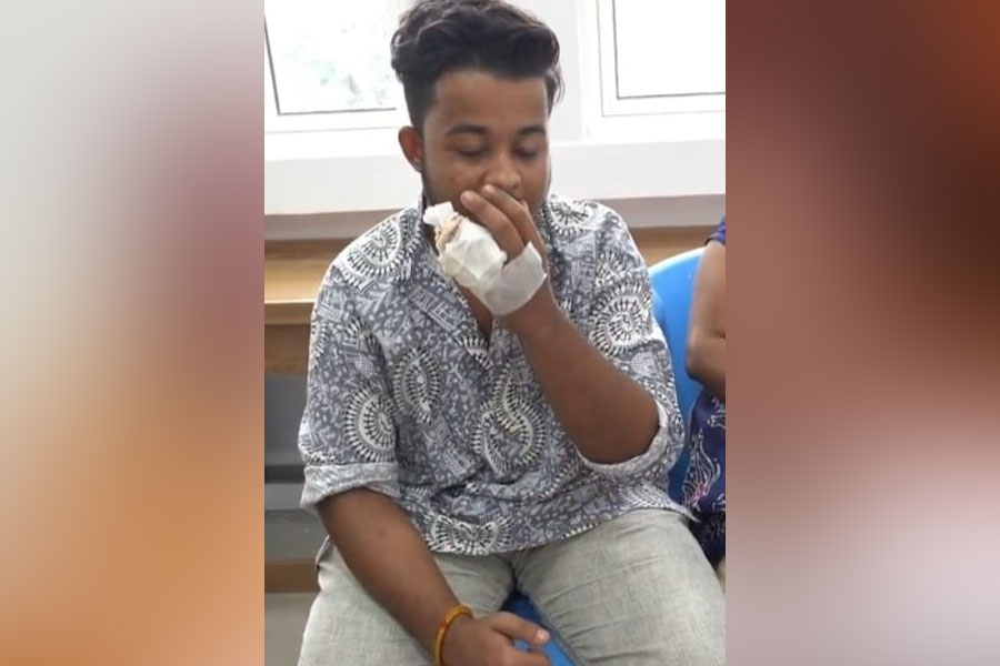 তাড়াহুড়োয় ব্যারিকেডে ধাক্কা লেগে আঙুল বাদ! ডেলিভারি বয়ের ‘ছিন্ন-আঙুল’ জুড়ল হাসপাতাল