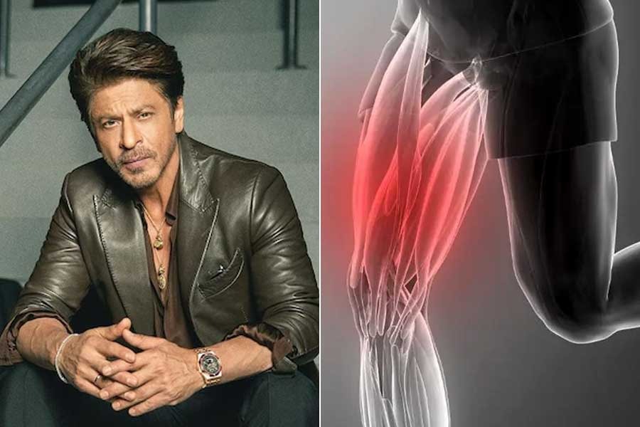 ‘কিং’ সেটে শাহরুখের চোট! পেশির আঘাত কীভাবে সারে? জানাচ্ছেন বিশেষজ্ঞ