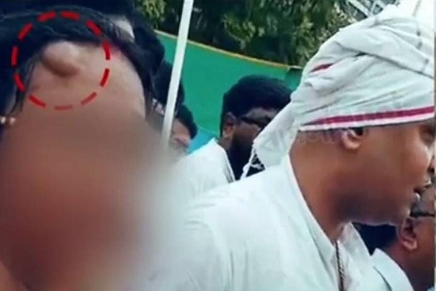 নবান্ন অভিযানে আহত অভয়ার মাকে হাঁটানো, দূরের হাসপাতালে ভর্তি কেন? উঠছে প্রশ্ন
