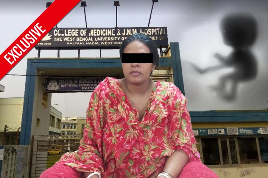 গর্ভেই বাস মৃত ‘পেপার ভ্রূণে’র, একই মায়ের আরও এক সন্তানকে বাঁচিয়ে রেকর্ড চিকিৎসকদের