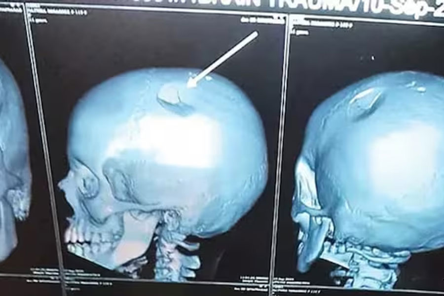 দুষ্টুমি করায় লাঞ্চ বক্স ছুড়লেন শিক্ষিকা, ষষ্ঠ শ্রেণির পড়ুয়ার মাথায় চিড়! দায়ের অভিযোগ 