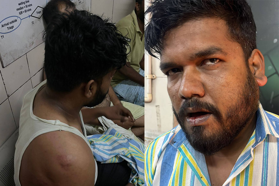 উৎসবের মরশুমে তুচ্ছ ঘটনায় উত্তপ্ত আসানসোল, বাজি ফাটানো নিয়ে মারামারিতে আহত ৫
