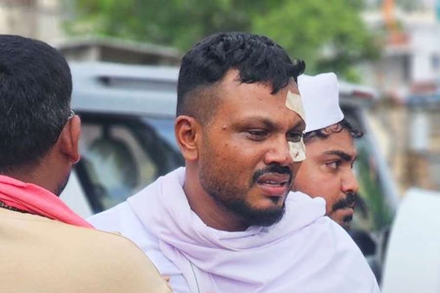 ৪ মাস পরও কাটেনি আতঙ্ক, কেমন আছেন আহমেদাবাদ দুর্ঘটনায় একমাত্র জীবিত রমেশ?