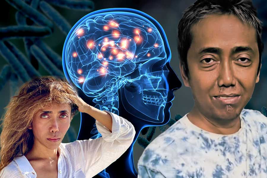 বিস্মৃতির অন্ধকারে টলিউড স্টাইলিস্ট স্যান্ডি! ব্রেন টিবি কেন ফুসফুসের থেকেও ভয়াবহ?